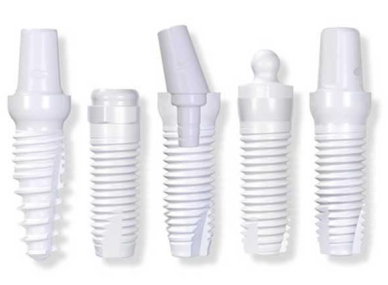 کاربردهای پزشکی آلومينا-ایمپلنت‌های دندانی اکسید آلومینیوم .